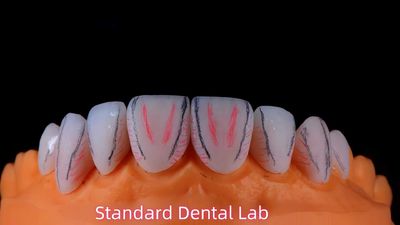Standard Dental Lab Co., Limited linea di produzione del fabbricante