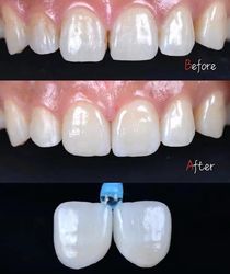 Standard Dental Lab Co., Limited linea di produzione del fabbricante