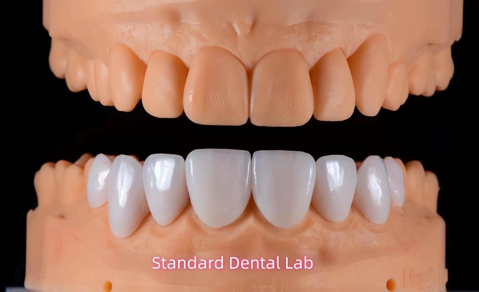 Standard Dental Lab Co., Limited linea di produzione del fabbricante
