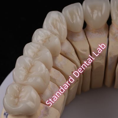 comprare Digital CAD CAM Dental Lab PFZ Corone Traslucide a strati Corona di zirconia fabbricazione online
