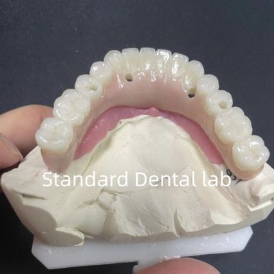 comprare Restauro estetico tutti su 4 impianti dentali zirconia ipoallergenico fabbricazione online