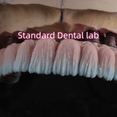 comprare Vattone per il ponte dell'impianto di zirconia mantenuto con porcellana di gomma rosa fabbricazione online