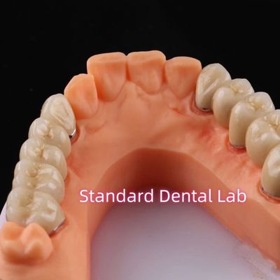comprare Dentistico digitale in porcellana di metalli non preziosi fabbricazione online
