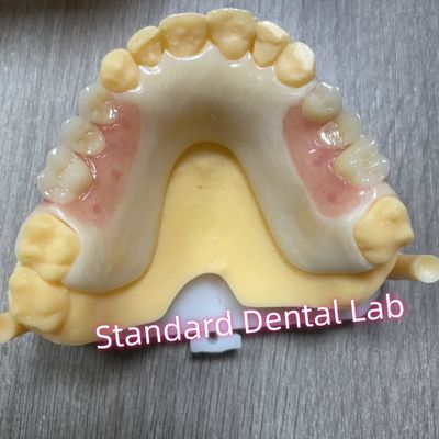 comprare Denti di ombra superiore Quadro acetalico Chiusura acrilica Denti parziali rimovibili fabbricazione online
