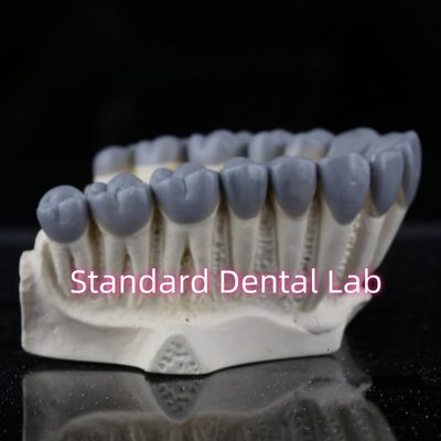 comprare SDL Dental Lab Digital Diagnostic Wax Ups Crown Bridge fabbricazione online