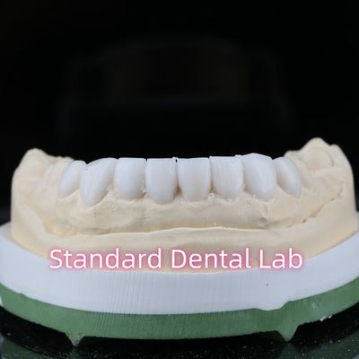comprare Diagnostica Restorativa Odontoiatria Ceramica Finiture Alta estetica fabbricazione online