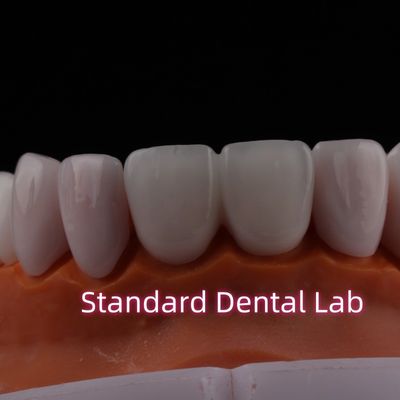 comprare Traslucide Emax Zirconia Finiture laminate Porcellana Finiture dentali Verystable chimicamente fabbricazione online