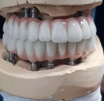 comprare Cimento a vite per impianti di zirconia di precisione conservato per denti di aspetto naturale fabbricazione online