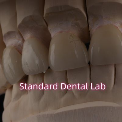 comprare Laboratorio dentale professionale Corona di zirconia per restauro fisso fabbricazione online