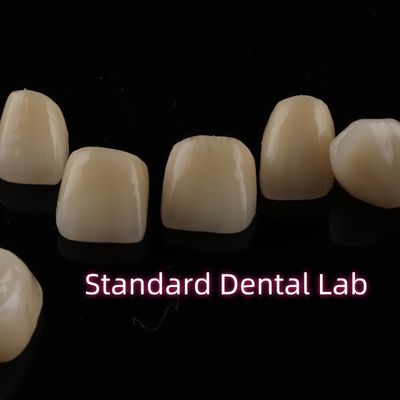 comprare Corone dentali in zirconia a strati forti fabbricazione online