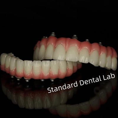 comprare Impianto di cemento a vite Restaurazioni dentali trattenute dal laboratorio dentale standard fabbricazione online