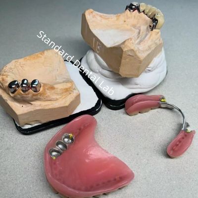 comprare Alta estetica CAD CAM dente partiale protesi sostituzione attaccamento laboratorio dentale standard fabbricazione online