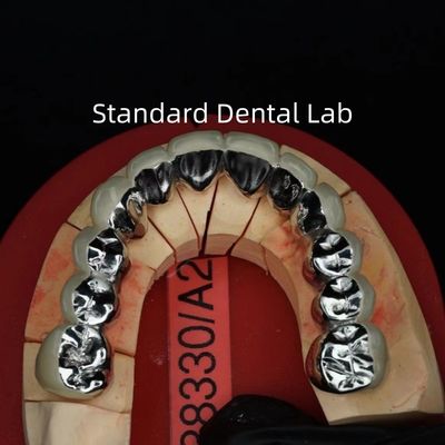 comprare Corone di porcellana in metallo a arco pieno / ponte di precisione estetica PFM corona dentale fabbricazione online