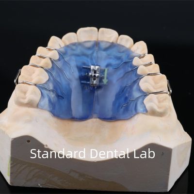 comprare Espansivo per denti e palati a vite estraibile per ortopedia fabbricazione online