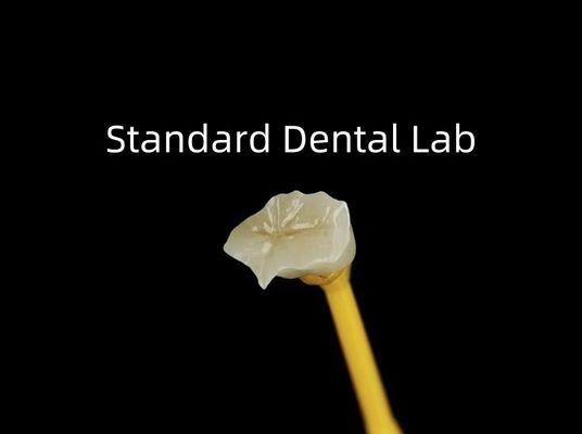 comprare Dental Porcellana Inlay Onlay Zirconia Emax Alta estetica fabbricazione online