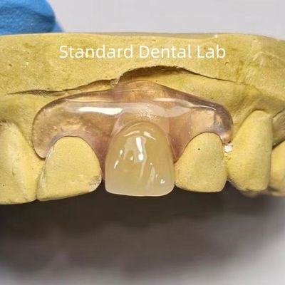 comprare Dental TCS Valplast Flessibili protesi parziali Sfalancianti antiodori fabbricazione online