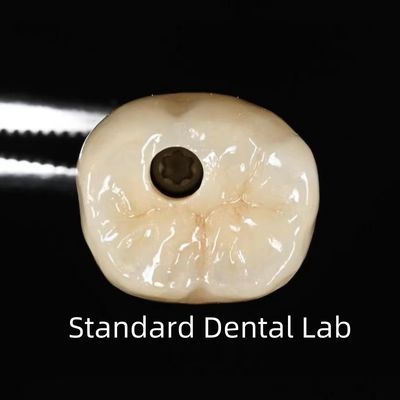 comprare Corone di impianto dentale a vite fabbricazione online