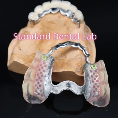 comprare Attachment di precisione rimovibile Nuova protesi parziale in Valplast Ace rosa / scuro fabbricazione online