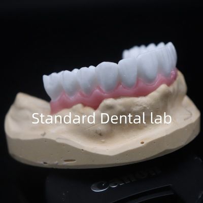 comprare Alta estetica corona dentale bianca ceretta diagnostica su misura laboratorio dentale cinese fabbricazione online