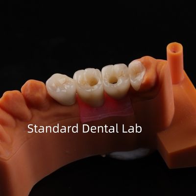 comprare Porcellana Zirconia Dental Implant Bridge Professionale Alta Estetica fabbricazione online
