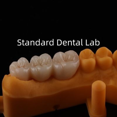 comprare Be Ni Free Metal Porcellana Corone Precise Estetica PFM Corona dentale fabbricazione online