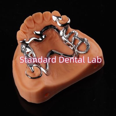 comprare Cobalt Chrome Framework Ni Be Free protesi dentale rimovibile China Dental Lab fabbricazione online