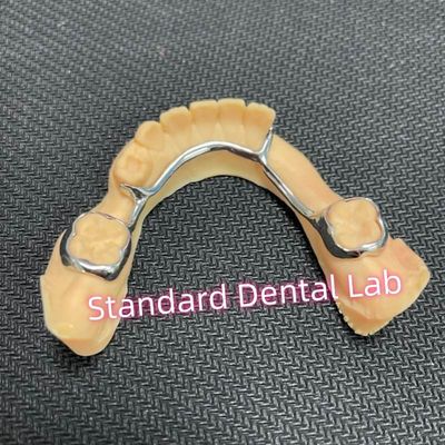 comprare Mantenitore di spazio bilaterale dentale per denti mancanti Arco di presa linguale fabbricazione online