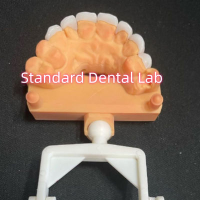 comprare Laminato di zirconia Emax di aspetto naturale fabbricazione online