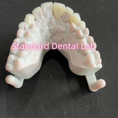 comprare Denti dentali di Star's Smile Emax Zirconia Finiture laminate 0,6 mm fabbricazione online