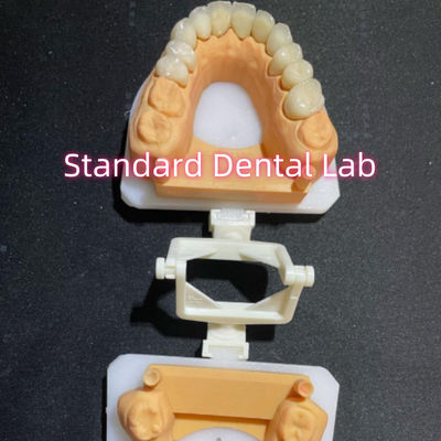 comprare Dental Restorative Odontoiatria Cura orale Corona completa in zirconia personalizzata fabbricazione online