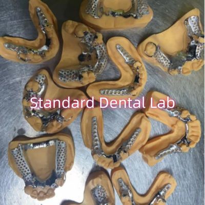 comprare Denti parziali con telaio in metallo fuso a cromo di cobalto rimovibile fabbricazione online