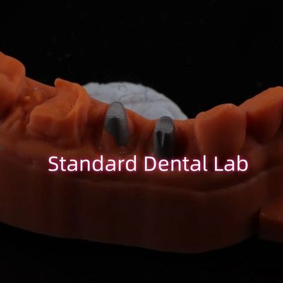 comprare Corone post-core in metallo CAD CAM Porcellana / zirconia coping corone bruxier in zirconia completa fabbricazione online