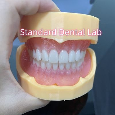 comprare Alta estetica dentiera acrilica completa superiore e inferiore dentiera ivoclare gomma rosa fabbricazione online