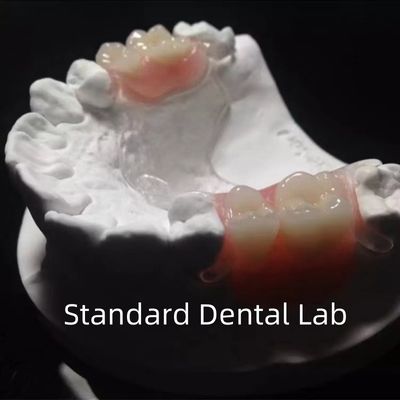comprare Flessibile Quadro in metallo chiaro Fuso Protesi parziali Alta estetica Perfetta vestibilità fabbricazione online