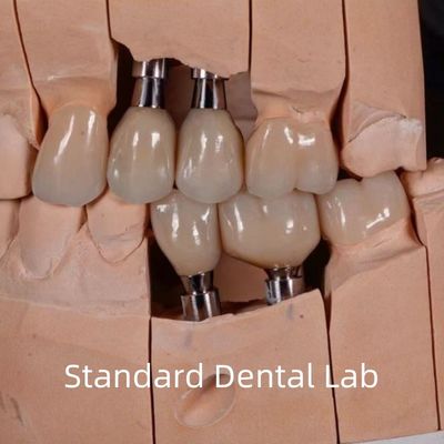 comprare Corone di impianto di zirconia a vite estetica dall' aspetto naturale fabbricazione online