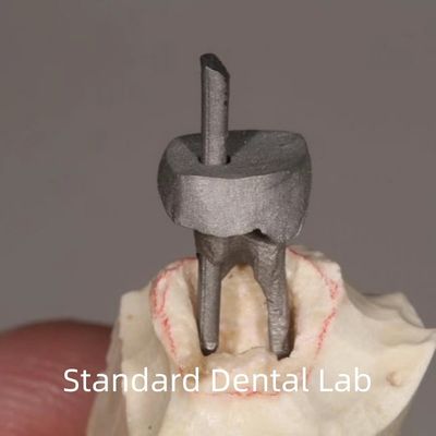 comprare Restituzione dentale Colpo di metallo e corona perfetto. fabbricazione online