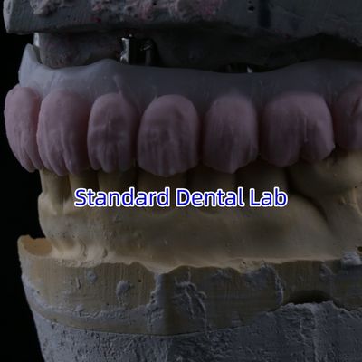 comprare Porcellana tutto su quattro Ponte di zirconia Ponte di impianti dentali di alta estetica fabbricazione online