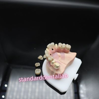 comprare Ponte per impianti dentali digitali di malo Titanio Ivoclar Hybrid Zirconia fabbricazione online