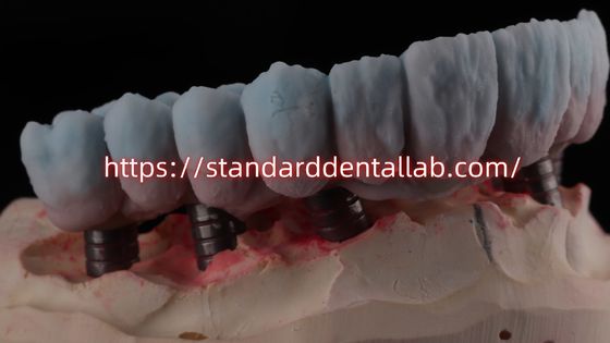 comprare Ponte di zirconia supportata da impianto con rivestimento in titanio fabbricazione online