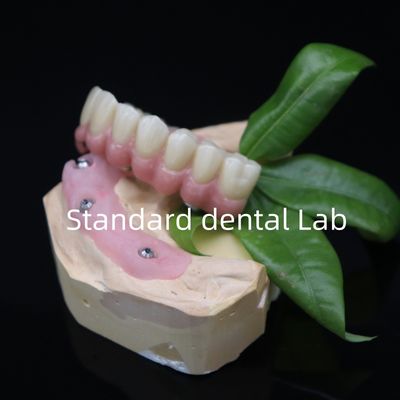 comprare Scurato tutto su 6 pieno Zirconia ponte dentale alta precisione su base Ti fabbricazione online