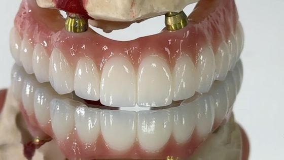 comprare Dental All On X Implantazione PFM Corona Titanio Fissa Protesi Ibrida fabbricazione online