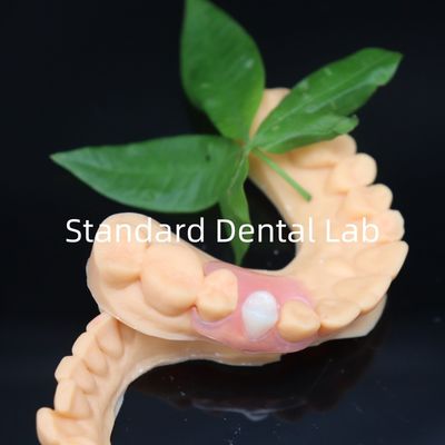comprare Protesi estetiche flessibili Valplast con polizza di ripulitura gratuita in 3 giorni China Dental Lab fabbricazione online