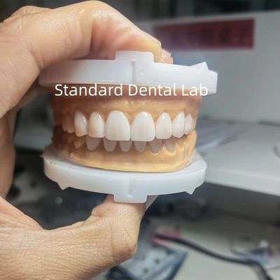 comprare Perfetta estetica Cera provvisoria per i dentisti che usano la cera dentale del laboratorio dentale cinese fabbricazione online