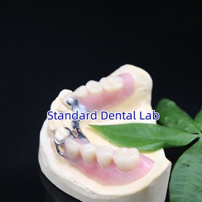 comprare Metalli acrilici cornici di protesi parziali alta estetica laboratorio dentale SDL fabbricazione online