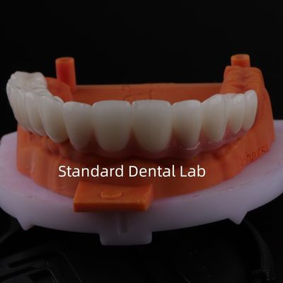 comprare Buona vestibilità Precise Esthetic Zirconia Porcellana Corona Rosa Porcellana Con Sfumatura Sbiancatrice fabbricazione online