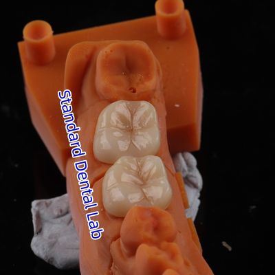 comprare Corone di zirconia a contorno completo traslucidità 3D PRO senza rivestimento in porcellana Laboratorio dentale standard fabbricazione online