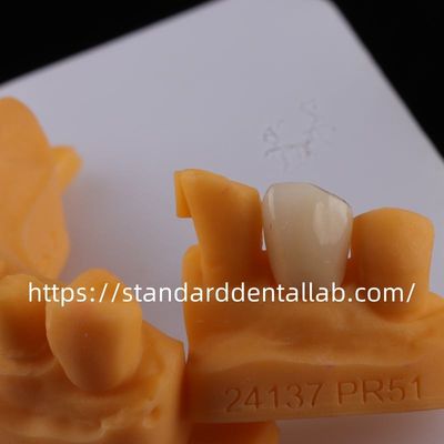 comprare Corone di laboratorio dentale a contorno completo di alta traslucidità Corone di zirconia solida fabbricazione online