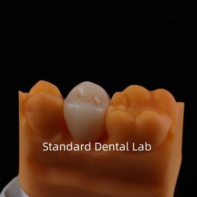 comprare Corona di zirconio di contorno completo Struttura e estetica eccezionali Nessuna sovrapposizione in porcellana Corona posteriore Laboratorio odontoiatrico cinese fabbricazione online