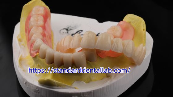 comprare Alta estetica dentale TCS Valplast Flessibile protesi parziali di laboratorio dentale Valplast Chiusura rosa fabbricazione online