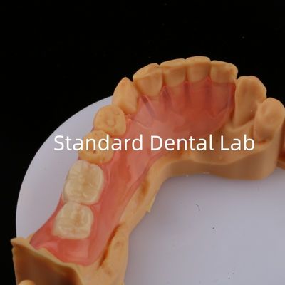 comprare Denti d'Asso Rosa/Oscuro TCS Valplast Protesi parziali flessibili per alta estetica Modello di stampa 3D dentale fabbricazione online